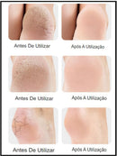 3 Pares de  Meia Palmilha Silicone Gel Ortopédica Calcanhar